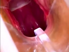 Vagina, cervix Rhythmically hit the orgasm vaginal endoscope with strong suction, squeezing and raising the spike.